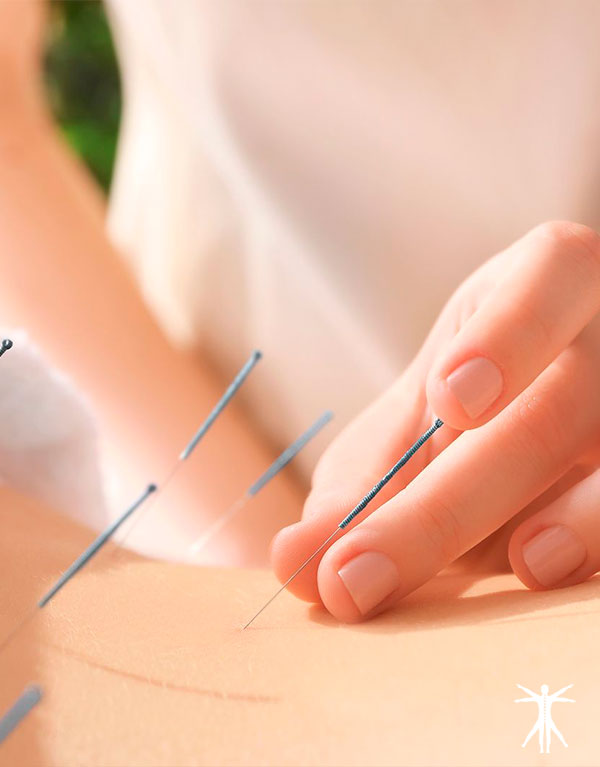 Curso de Técnico Superior en Acupuntura y MTC