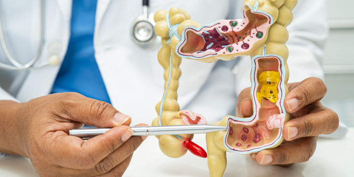 Detectan señales genéticas que podrían anticipar la enfermedad desde el intestino